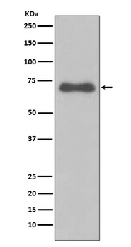NUMB Rabbit Monoclonal Antibody
