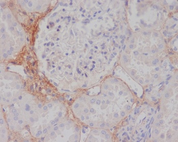 Anti-TGFBI/Beta Ig H3 Rabbit Monoclonal Antibody