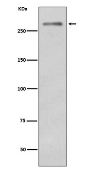 Dysferlin Rabbit Monoclonal Antibody