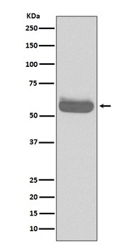 Occludin OCLN Rabbit Monoclonal Antibody