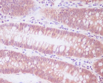 ENO1/Alpha Enolase Rabbit Monoclonal Antibody