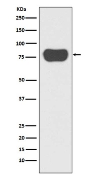 Cortactin CTTN Rabbit Monoclonal Antibody