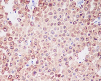 PMEL17/GP100 Rabbit Monoclonal Antibody