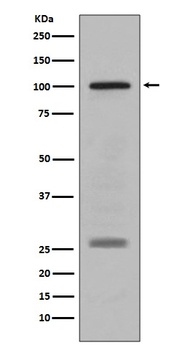 PMEL17/GP100 Rabbit Monoclonal Antibody
