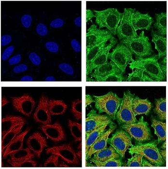 Anti-beta Actin ACTB Rabbit Monoclonal Antibody