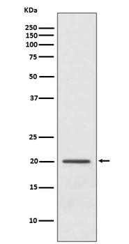 ARF1 Rabbit Monoclonal Antibody