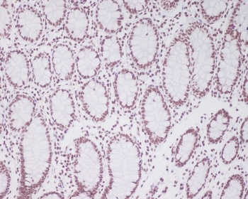 Anti-Pax2 Rabbit Monoclonal Antibody