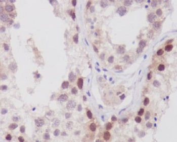 Anti-NUP98 Rabbit Monoclonal Antibody