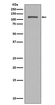 NUP98 Rabbit Monoclonal Antibody