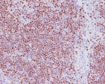 Anti-SATB1 Rabbit Monoclonal Antibody