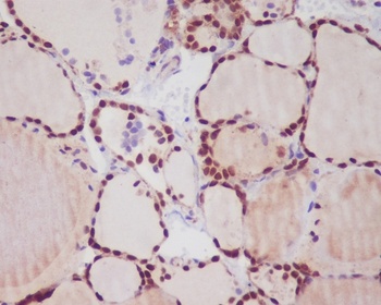 TTF1 NKX2-1 Rabbit Monoclonal Antibody