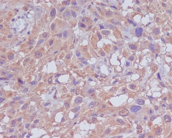 Anti-Neuropilin 1 NRP1 Rabbit Monoclonal Antibody
