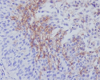 Anti-Thrombomodulin THBD Rabbit Monoclonal Antibody