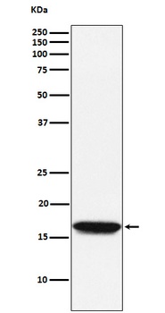 NM23A Rabbit Monoclonal Antibody