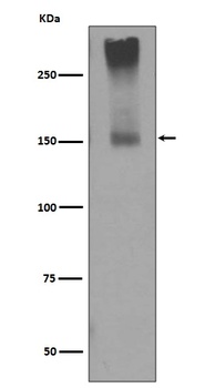 GRM5/Mglur5 Rabbit Monoclonal Antibody