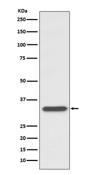 CD74 Rabbit Monoclonal Antibody