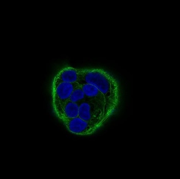 Anti-Cytokeratin 18 KRT18 Rabbit Monoclonal Antibody