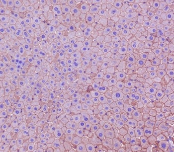 Anti-Cytokeratin 18 Krt18 Rabbit Monoclonal Antibody