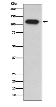 IDE/Insulysin Rabbit Monoclonal Antibody