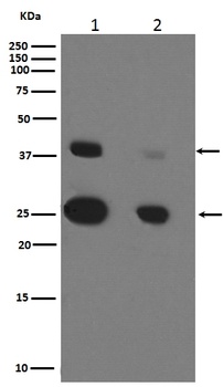 Cathepsin D CTSD Rabbit Monoclonal Antibody