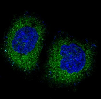 PKR EIF2AK2 Rabbit Monoclonal Antibody