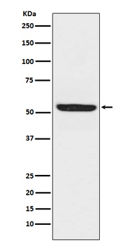 SPHK1 Rabbit Monoclonal Antibody