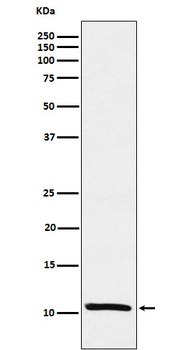 Estrogen Inducible Protein pS2 Rabbit Monoclonal Antibody