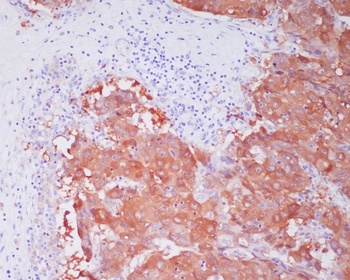 ALDH1A1 Rabbit Monoclonal Antibody