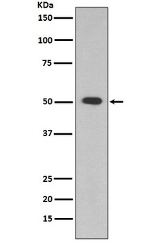 ALDH1A1 Rabbit Monoclonal Antibody