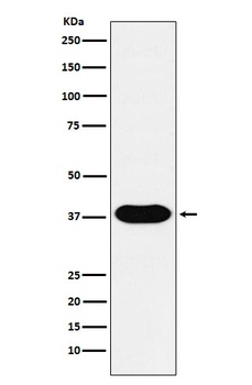 CD79B Rabbit Monoclonal Antibody