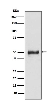 Anti-Cytokeratin 8 KRT8 Rabbit Monoclonal Antibody