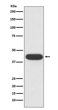 CD32 FCGR2A Rabbit Monoclonal Antibody