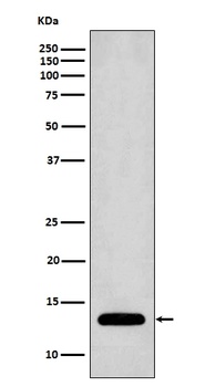 Profilin1 PFN1 Rabbit Monoclonal Antibody