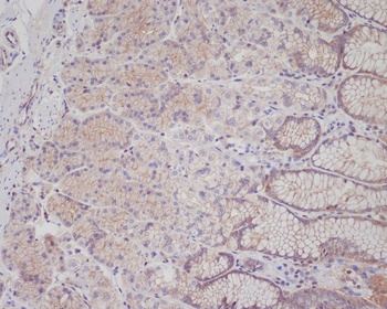 Met (c-Met) Rabbit Monoclonal Antibody