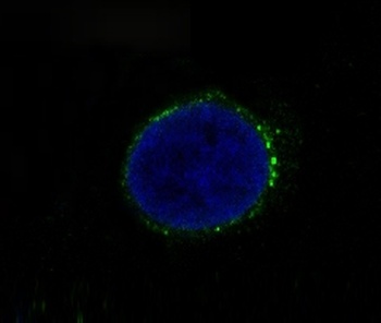 Anti-Met (c-Met) Rabbit Monoclonal Antibody