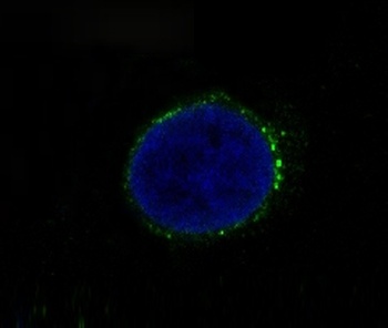 Met (c-Met) Rabbit Monoclonal Antibody