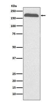 A2M/Alpha 2 Macroglobulin Rabbit Monoclonal Antibody