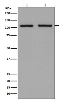 Anti-Hexokinase 1 HK1 Rabbit Monoclonal Antibody