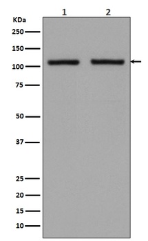 Hexokinase 1 HK1 Rabbit Monoclonal Antibody