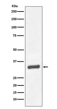 PSA/KLK3 Rabbit Monoclonal Antibody