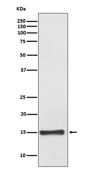 FABP4/A Fabp Rabbit Monoclonal Antibody