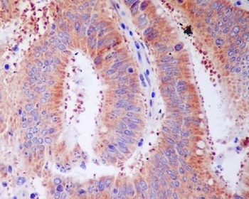 RPS3/Ribosomal Protein S3 Rabbit Monoclonal Antibody