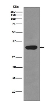 RPS3/Ribosomal Protein S3 Rabbit Monoclonal Antibody