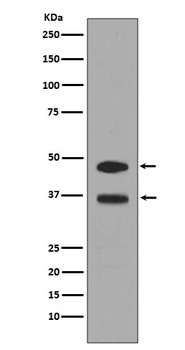 Fos B Rabbit Monoclonal Antibody