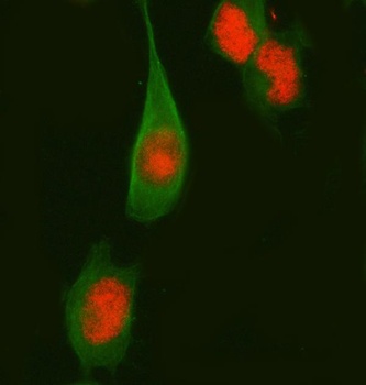 Fos B Rabbit Monoclonal Antibody