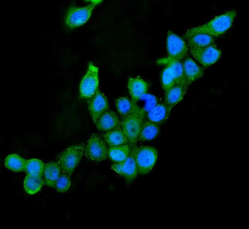 Anti-AIF/AIFM1 Antibody (monoclonal, 2I5)
