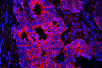 Anti-AIF/AIFM1 Antibody (monoclonal, 2I5)
