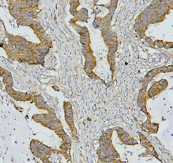 Anti-AIF/AIFM1 Antibody (monoclonal, 2I5)