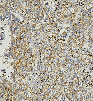 Anti-AIF/AIFM1 Antibody (monoclonal, 2I5)