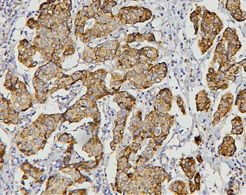 Anti-AIF/AIFM1 Antibody (monoclonal, 2I5)